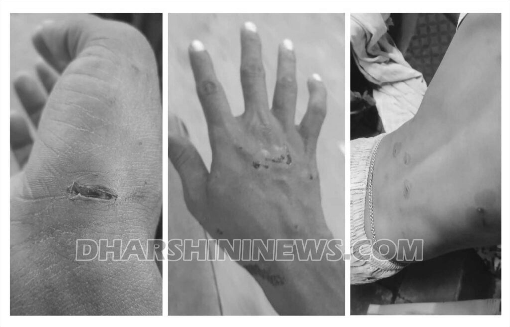 వీధి కుక్క‌ల వీరంగం..!