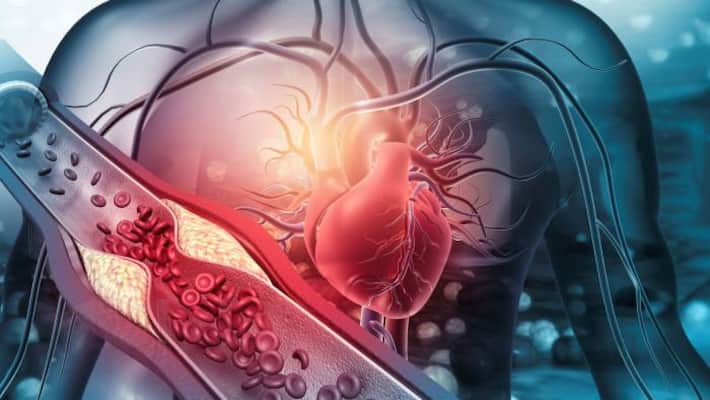 కొలెస్ట్రాల్‌కు చెక్ పెడ‌దామిలా