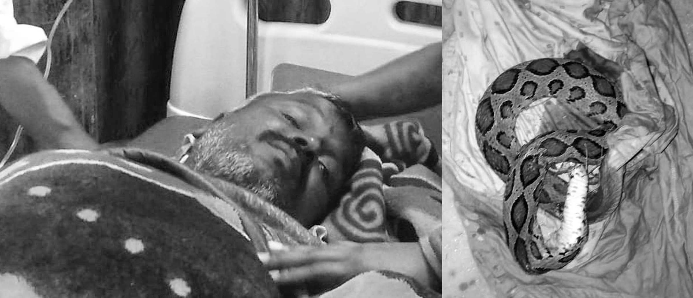 కాటేసిన కొండచిలువతో ఆసుపత్రికి వచ్చిన రైతు