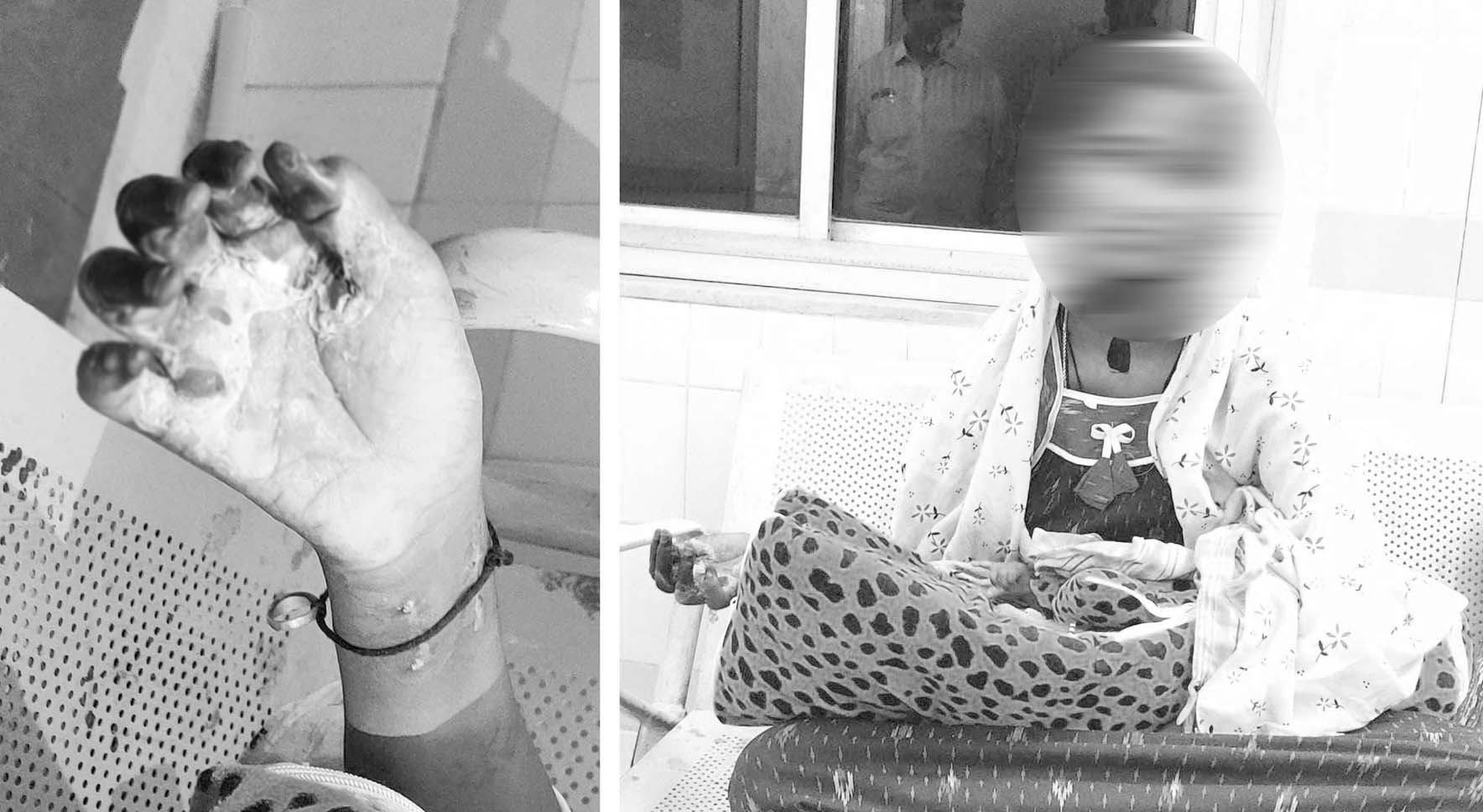 ఆ వైద్యమే విషమైంది..!