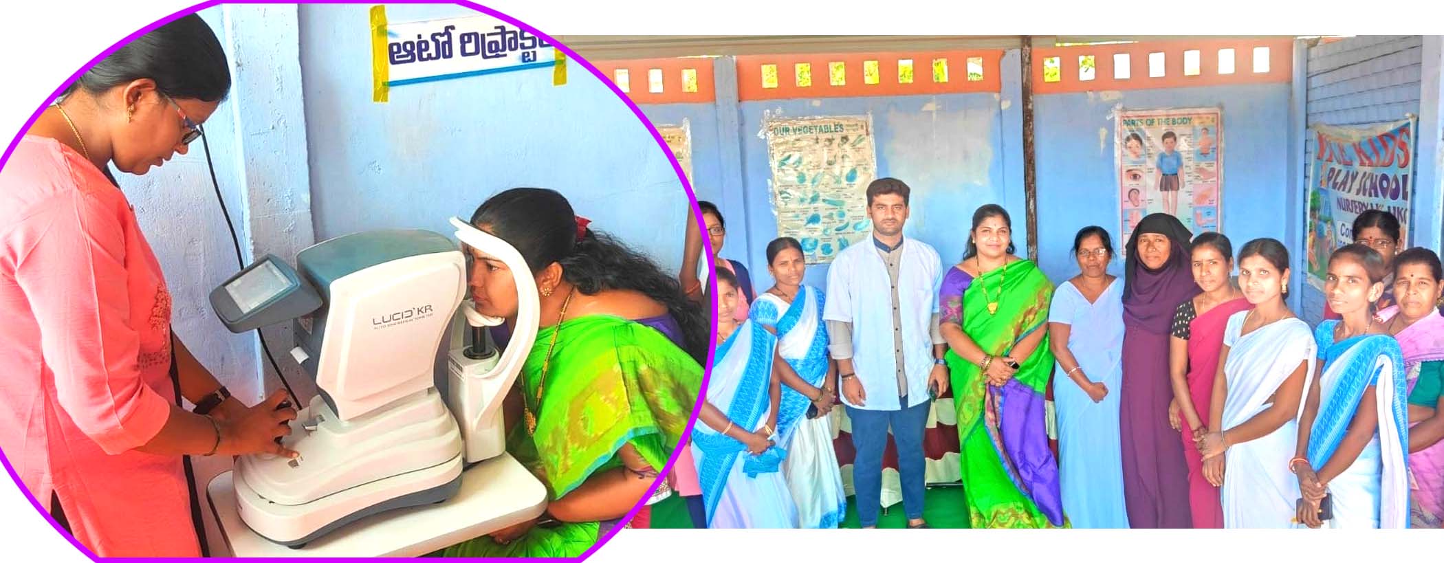 కంటి వెలుగు దేశానికి ఆదర్శం