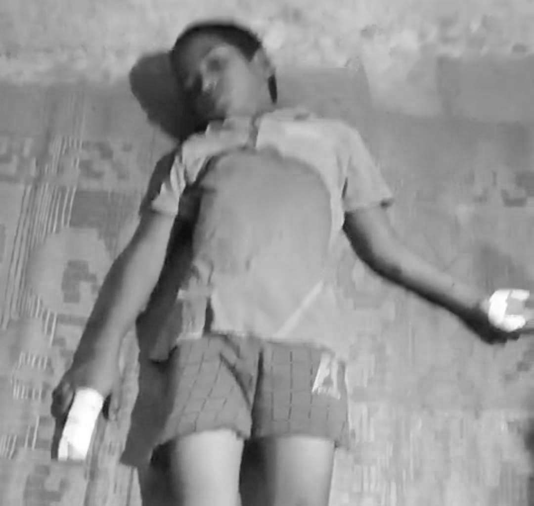 బాలుడిపై వీధికుక్క దాడి
