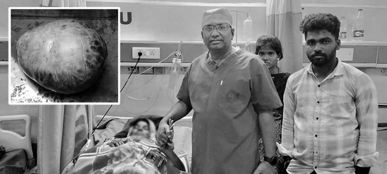మహిళ కడుపులో 8 కిలోల గడ్డ..!