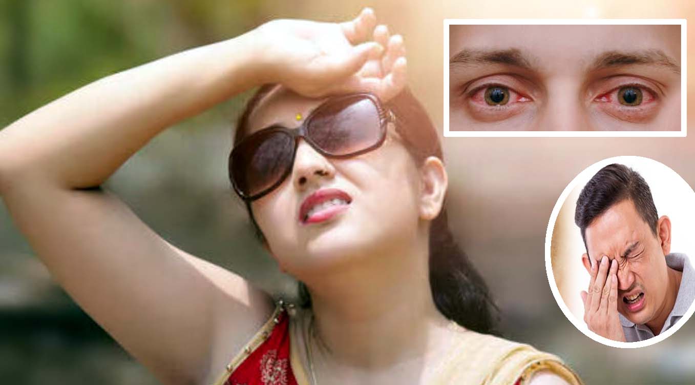 సమ్మర్‌లో 'ఐ' కేర్..!