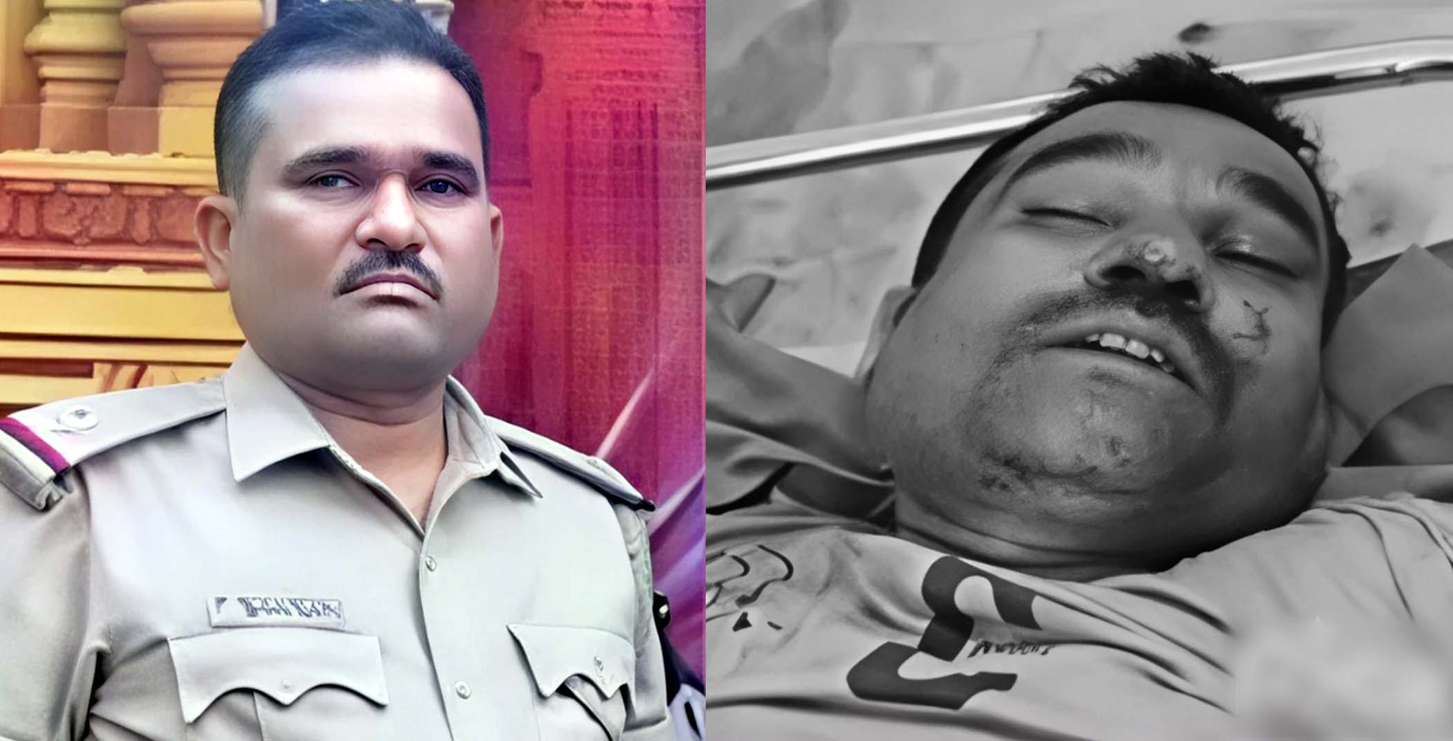 చికిత్స పొందుతూ కన్నుమూశాడు..!