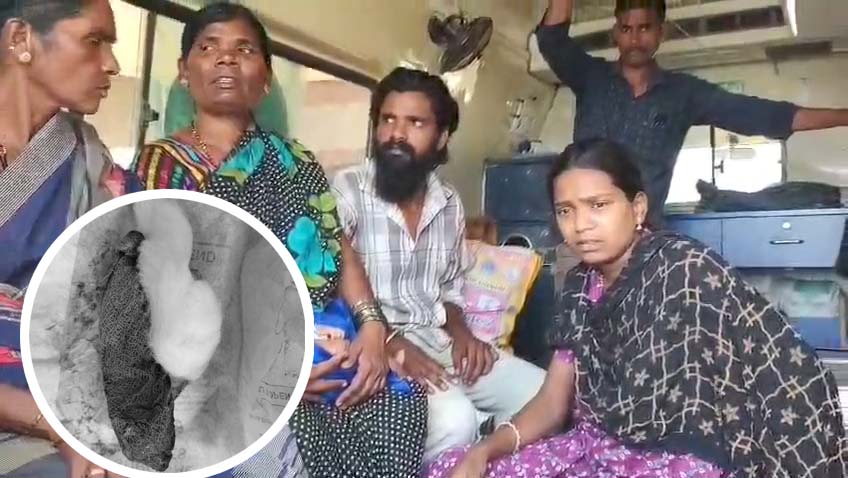 దూది మరిచి.. కుట్లు..!